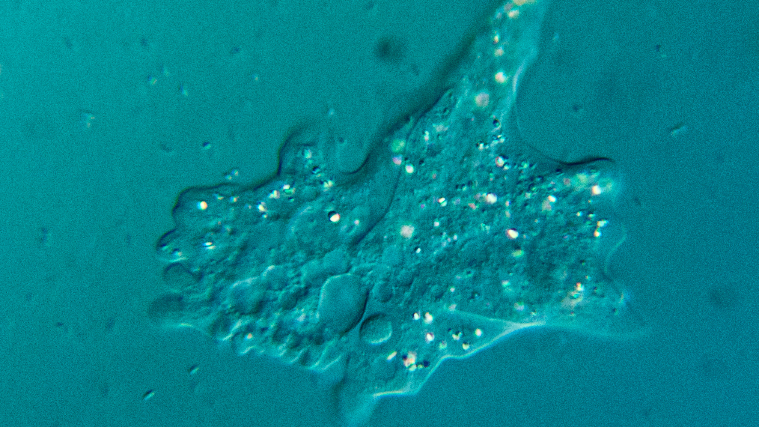 Исследователи обеспокоены ростом популяции смертельно опасных амеб